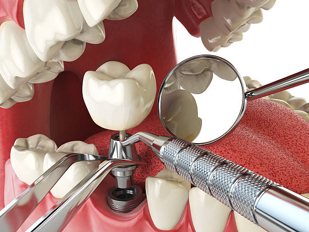 Best Holiday Emergency Dentist in Bon Air, VA